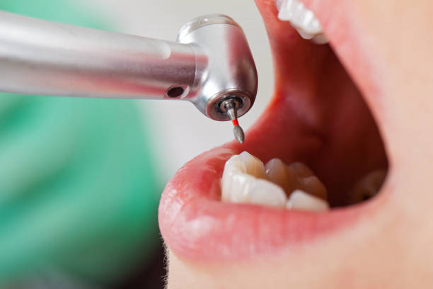 Best Weekend Emergency Dental Services in Monte Alto, TX